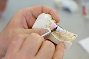 Dentist showing dental cast